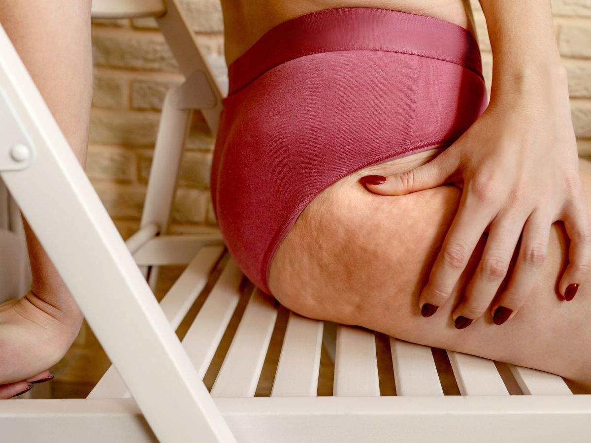 Weight loss Home remedies to get rid of cellulite naturally The Times of India