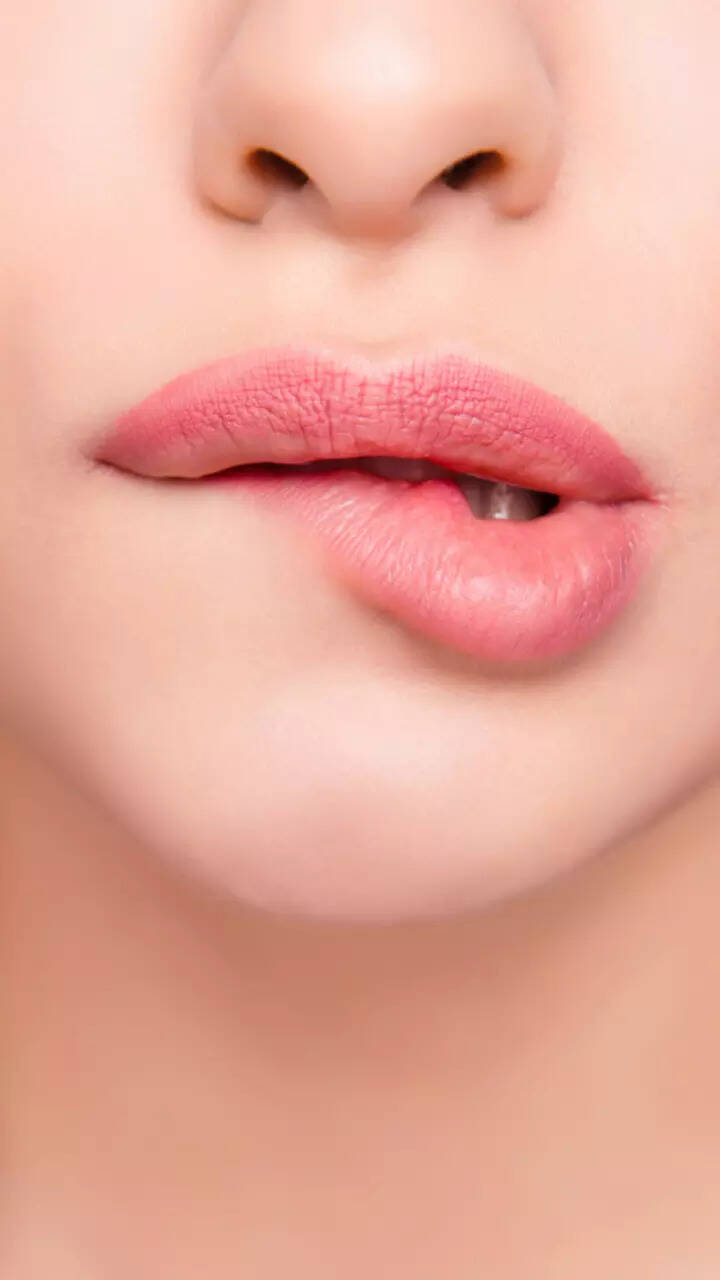 Dark Marks On Side Of Lips