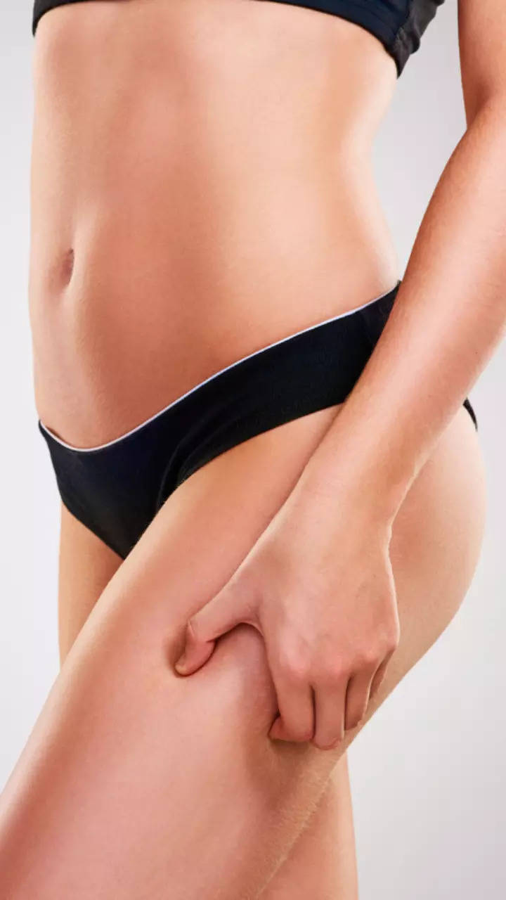 Dark inner thighs: Treatments and home remedies