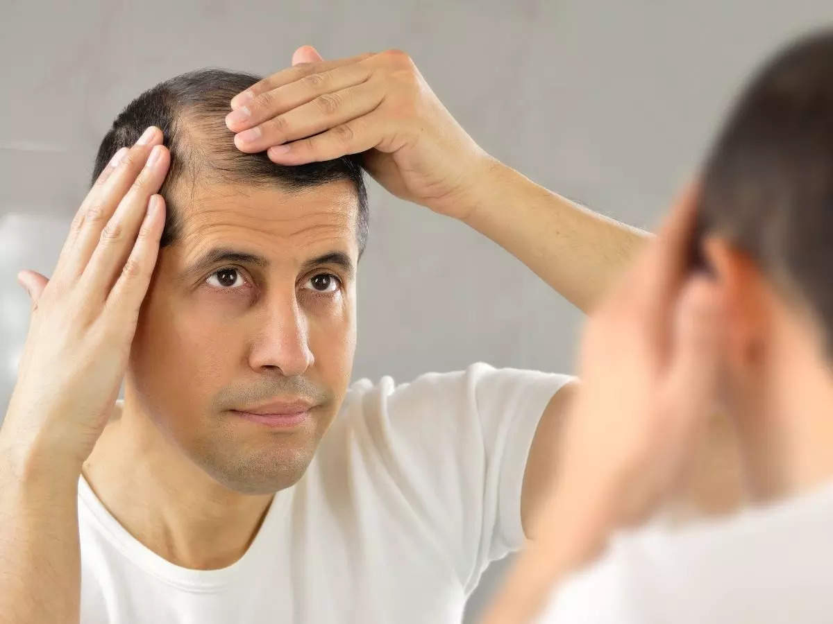 Coronavirus hair loss: Why it happens and will people who had COVID hair  loss during the second wave experience the same if they test positive  again? | The Times of India