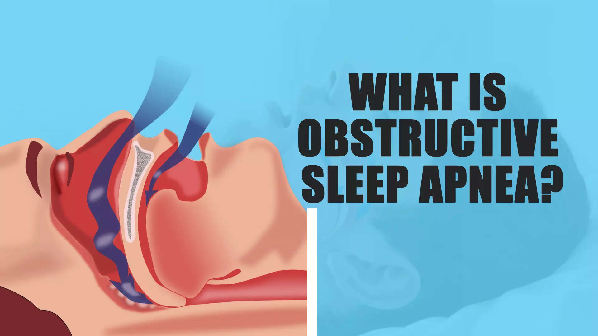 Why is obstructive sleep apnea concerning? Does it increase your risk ...