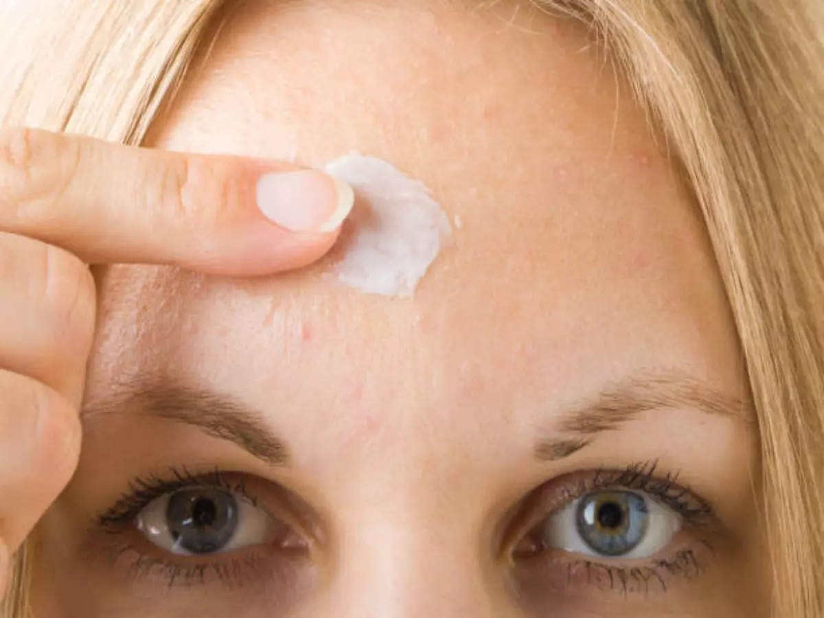 Suffering From Forehead Pimples These May Be The Causes Times Of India