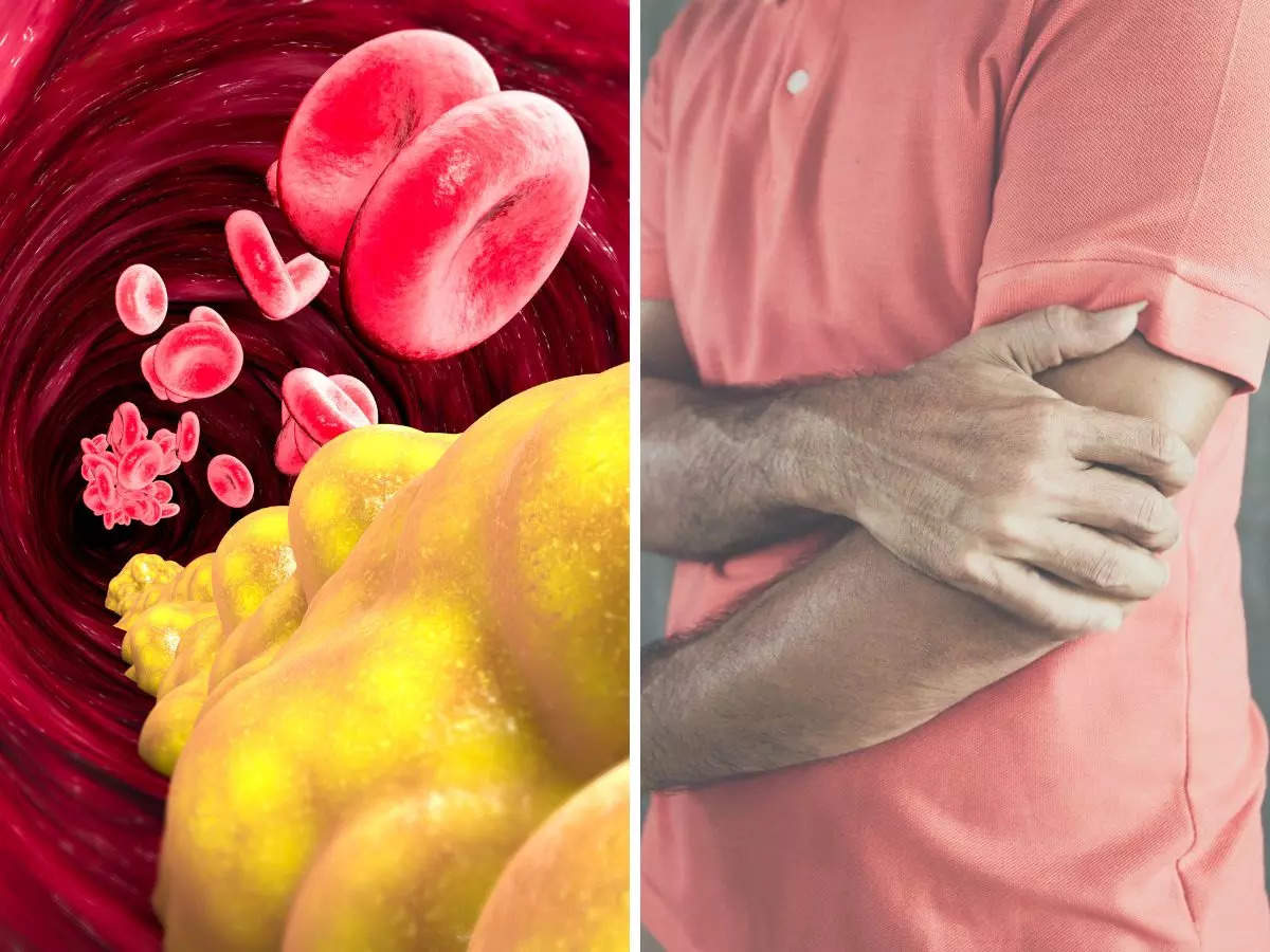 High cholesterol Symptoms: Two painful sensations to watch out for