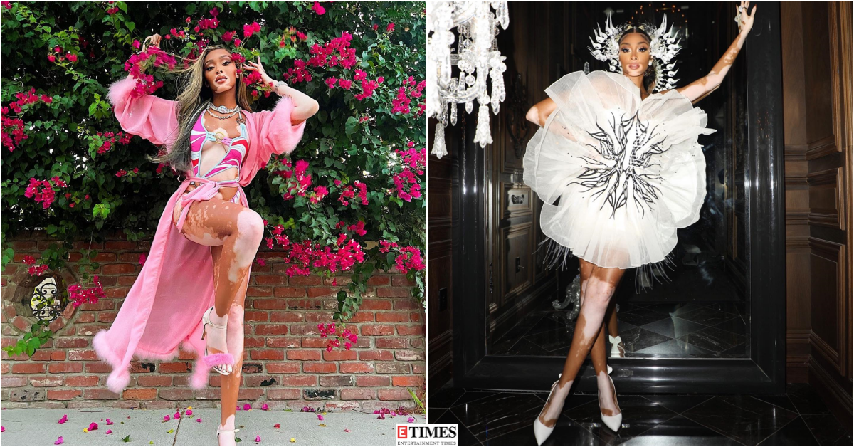 Winnie Harlow  turns up the heat with her glamorous photoshoots