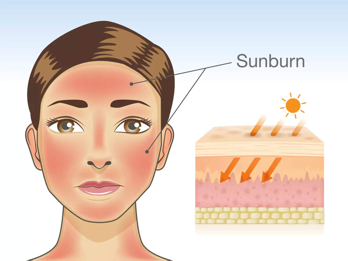 Woman’s ‘plastic’ forehead after sun exposure shocks Skin