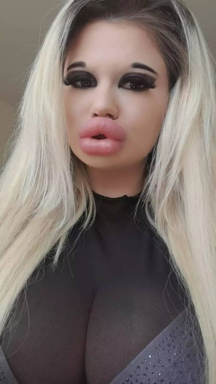 Meet Andrea Ivanova: Woman with worlds BIGGEST lips | Times of India