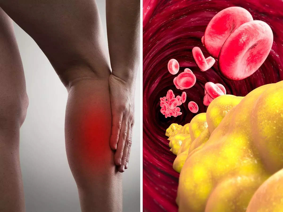 High cholesterol: Beware of these warning signs in your feet