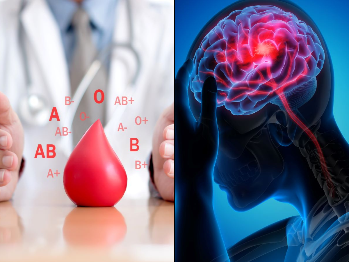 Your blood type may predict your risk of having a stroke before 60, says study