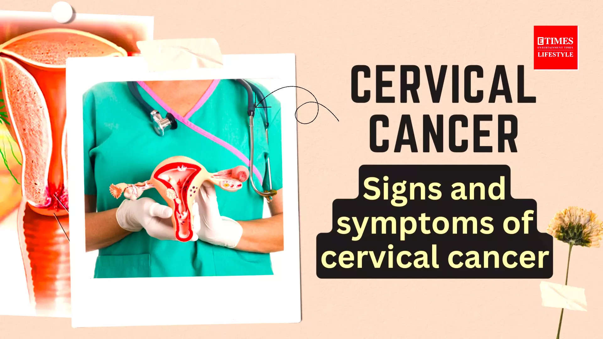 Cervical Cancer- Signs and symptoms of cervical cancer