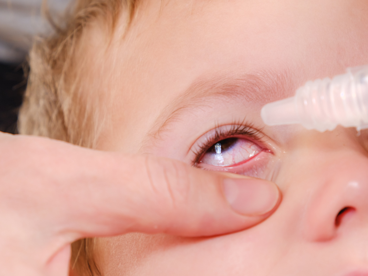 ​childhood Glaucoma: Parents Should Watch Out For These