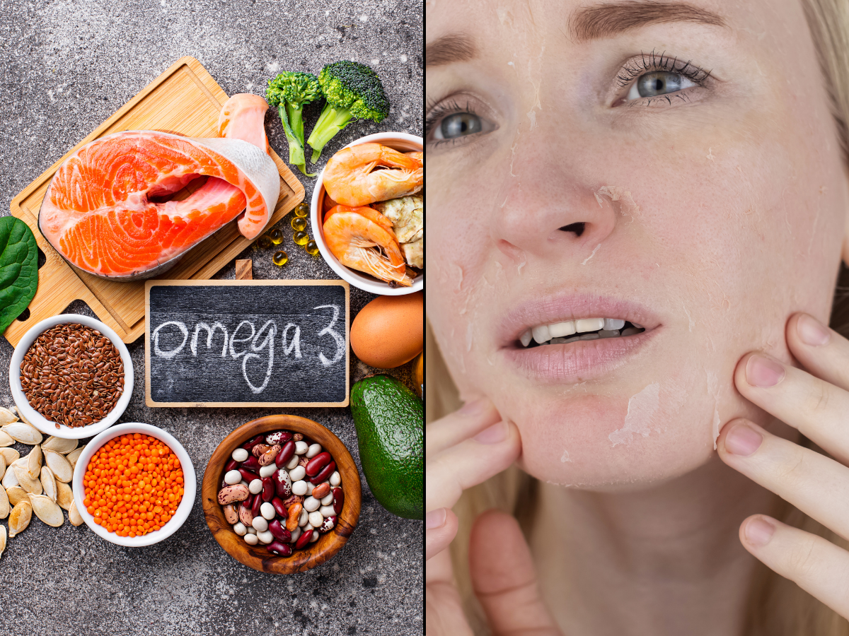 Omega-3 Deficiency Symptoms & How to Get Enough
