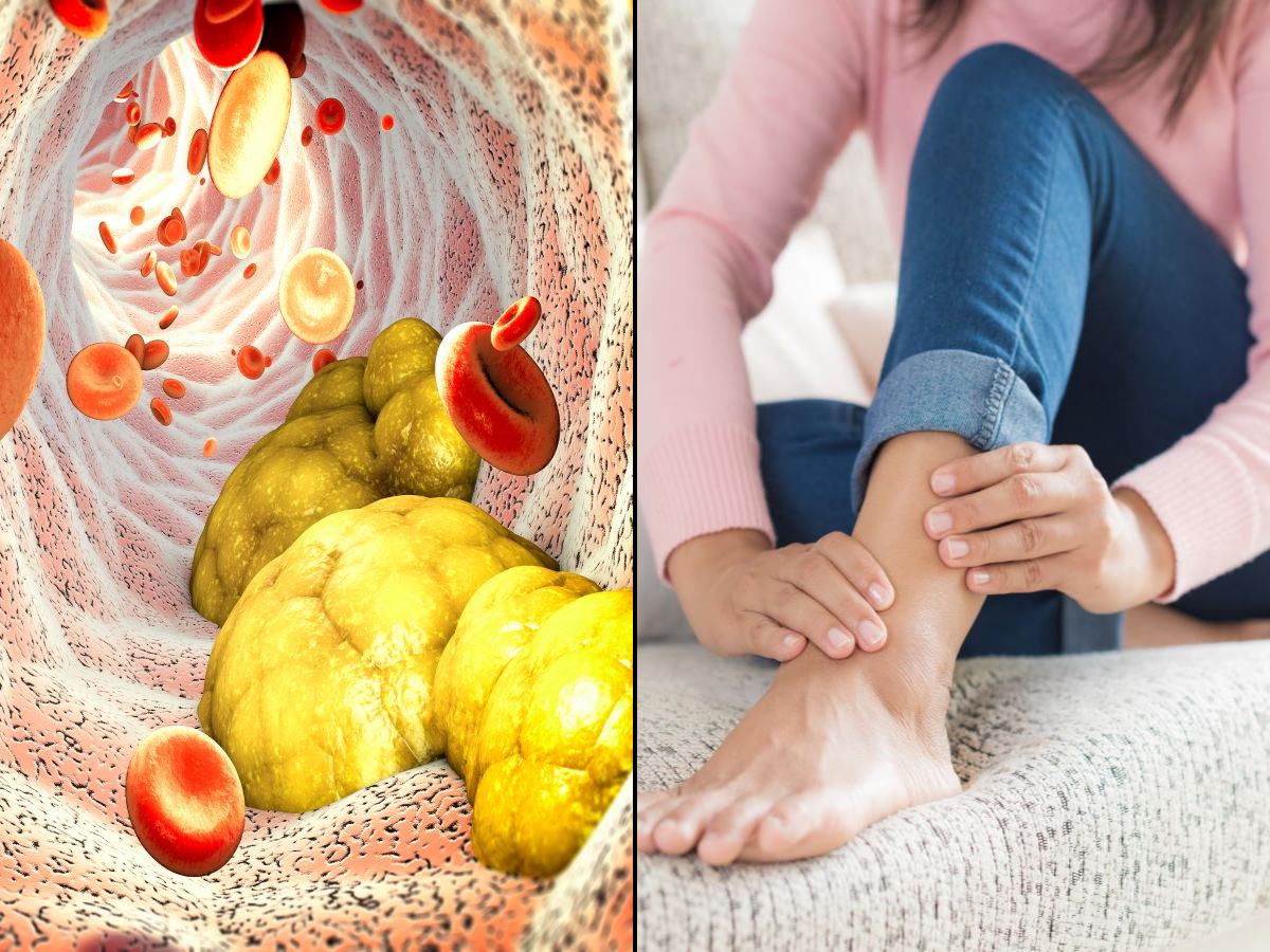 High cholesterol symptoms: THIS lesser-known sign could strike in