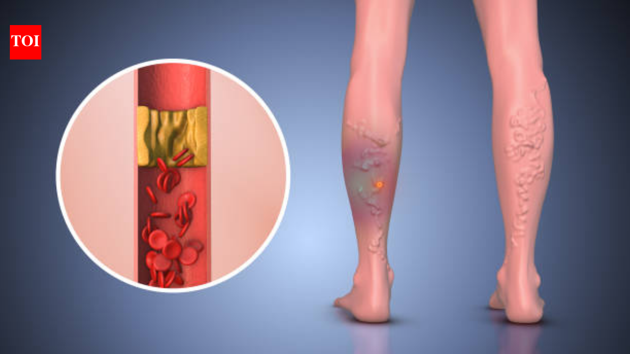 Recognizing Peripheral Vascular Disease: Key Symptoms to Watch