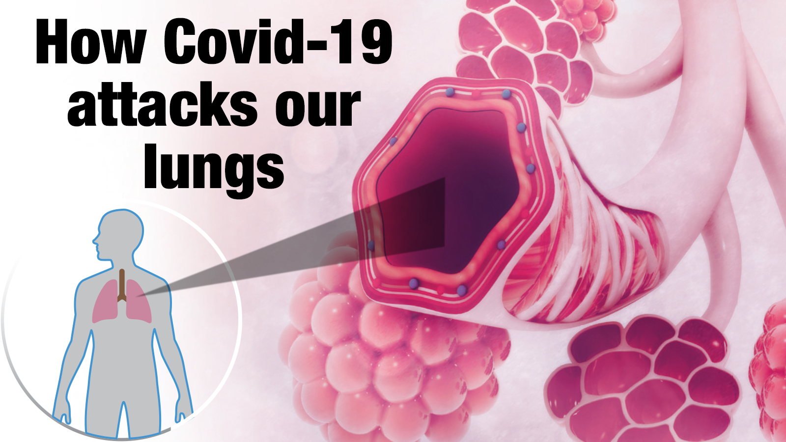 How Covid-19 attacks our lungs - Times of India