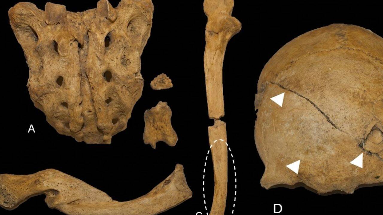 How did researchers identify signs of violence in ancient Scandinavian remains<br>