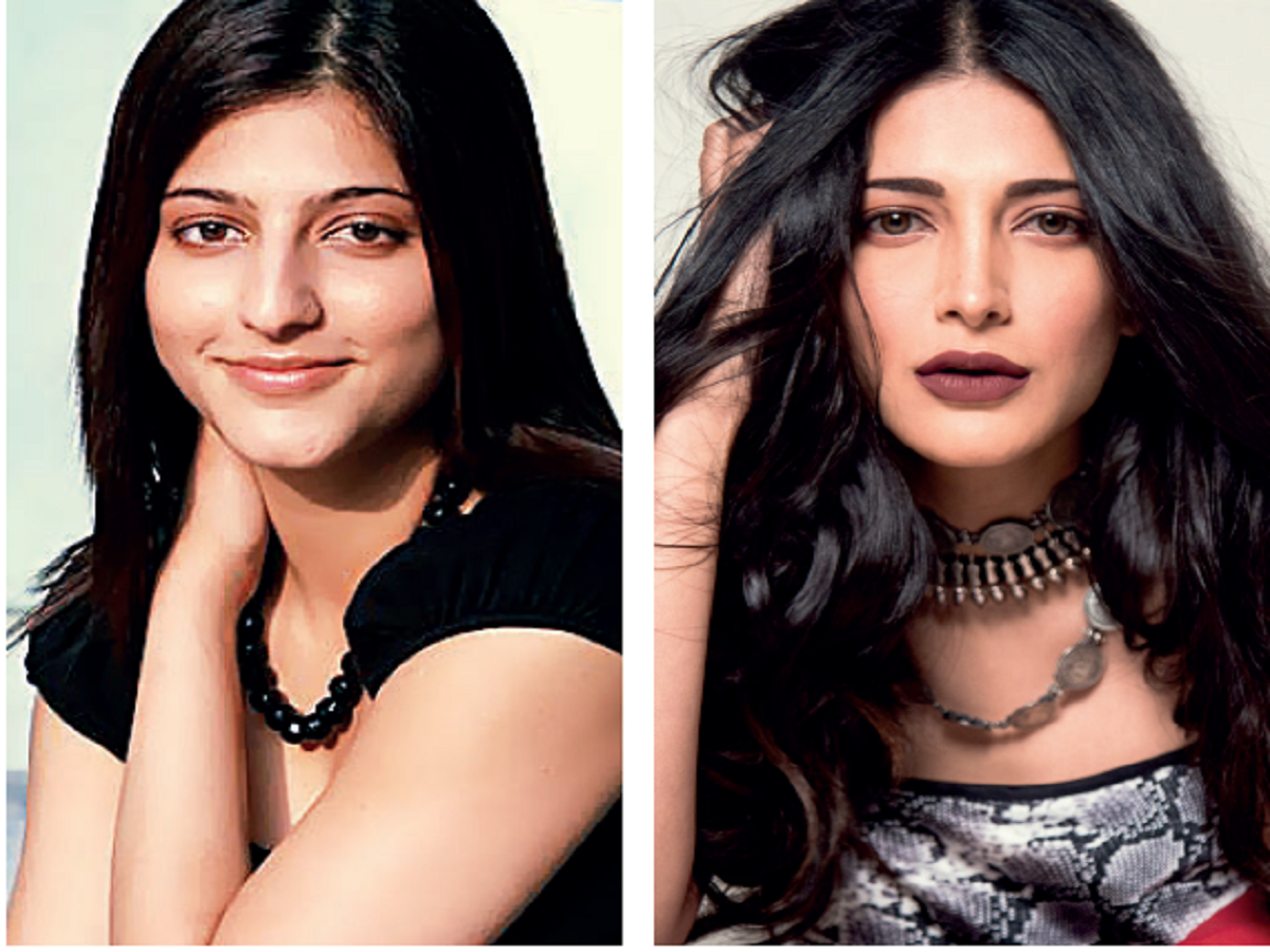 Shruti Haasan: There was a time I went crazy with lip fillers