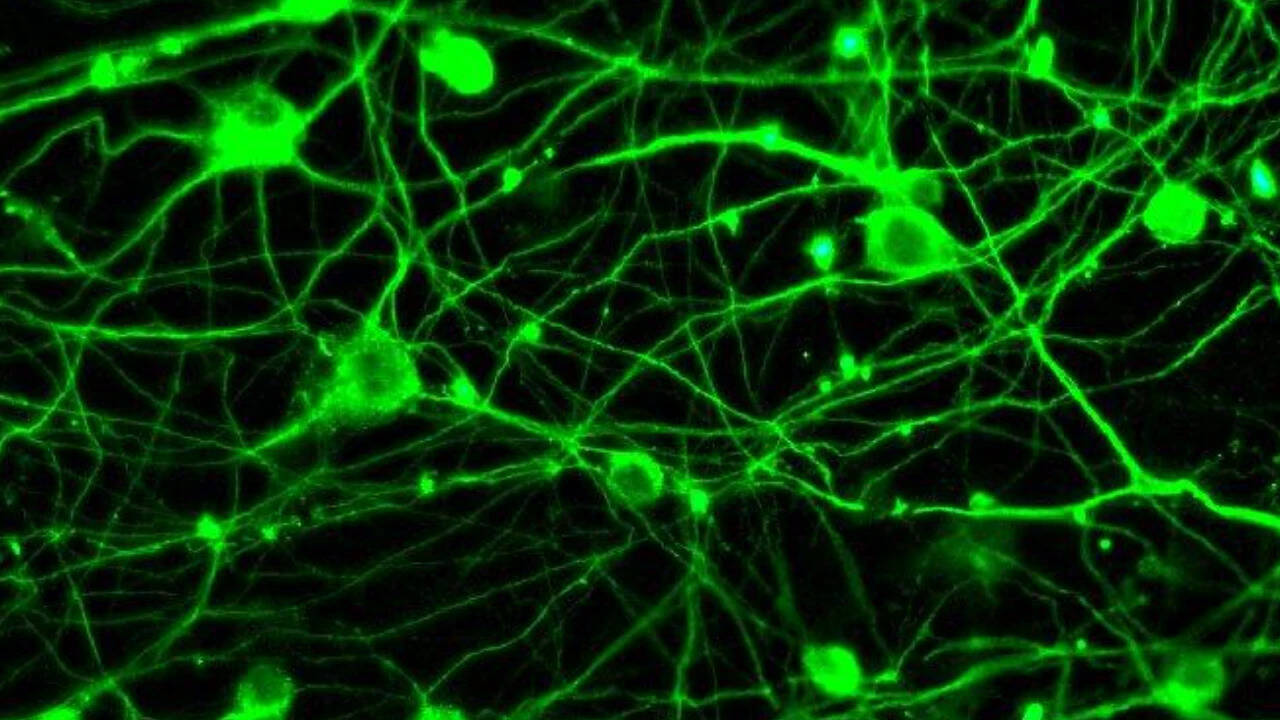 ​<strong> Why some people stay mentally sharp even when their brains show clear signs of Alzheimer’s disease</strong>​