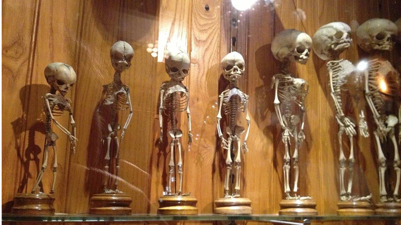 Mutter Museum