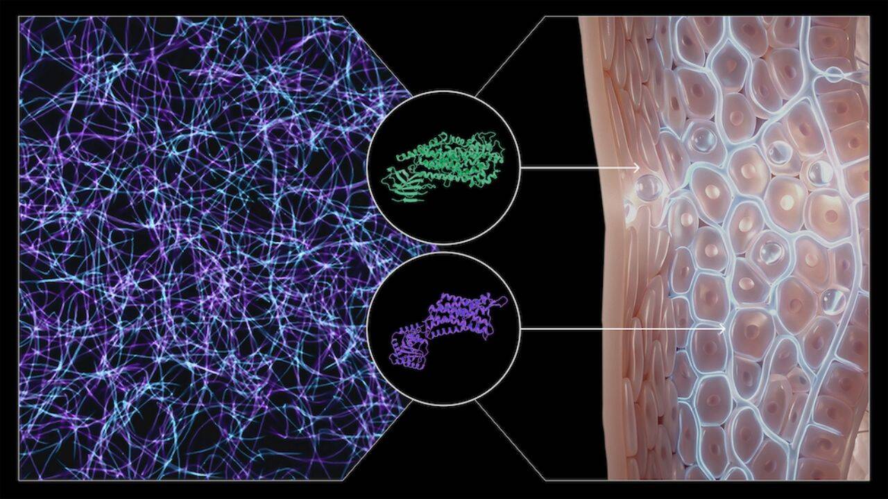 How AI and CRISPR revealed new psoriasis drug targets<br>