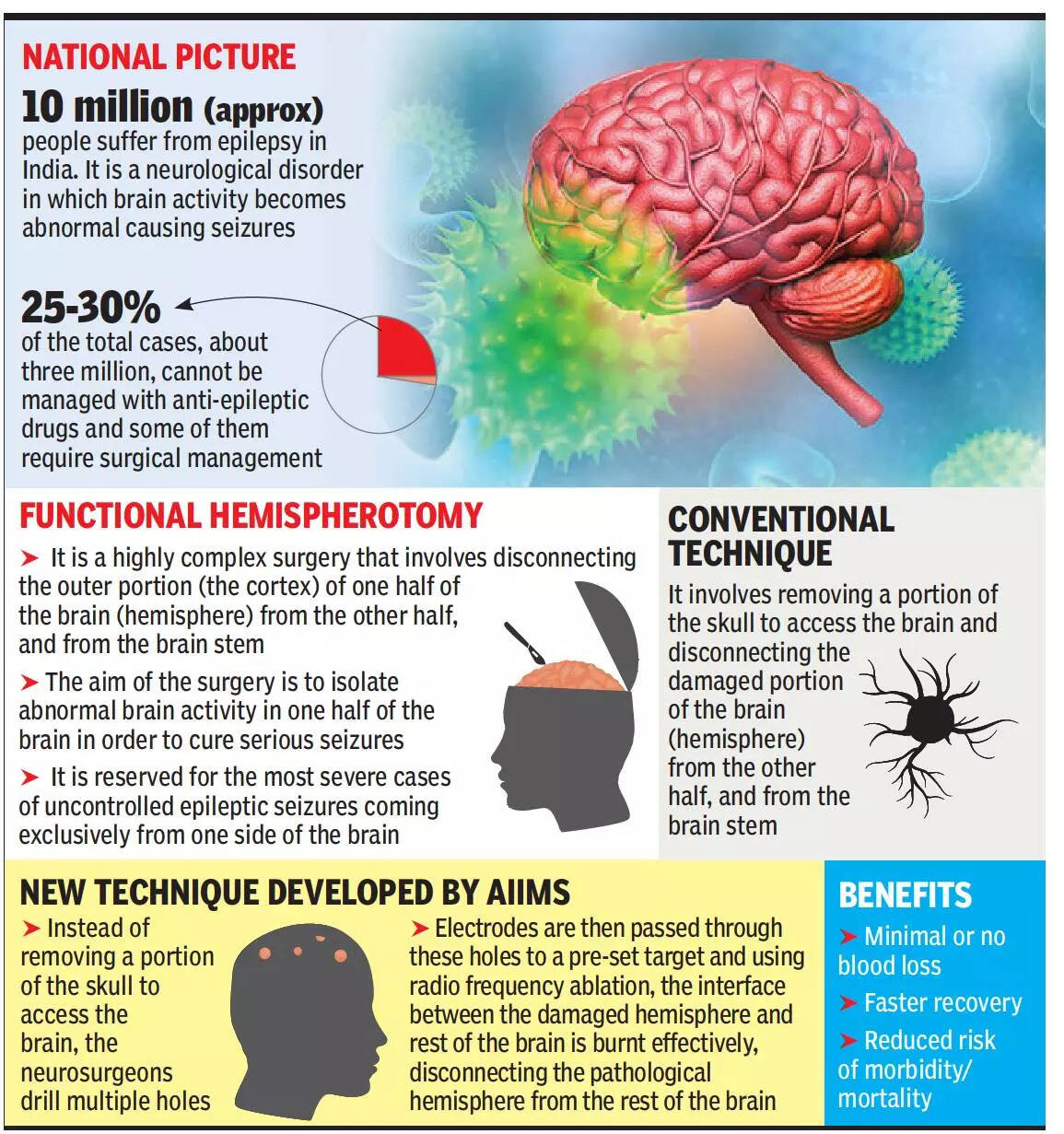 Electrodes In Brain New Hope For Severe Cases Of Epilepsy Delhi News Times Of India