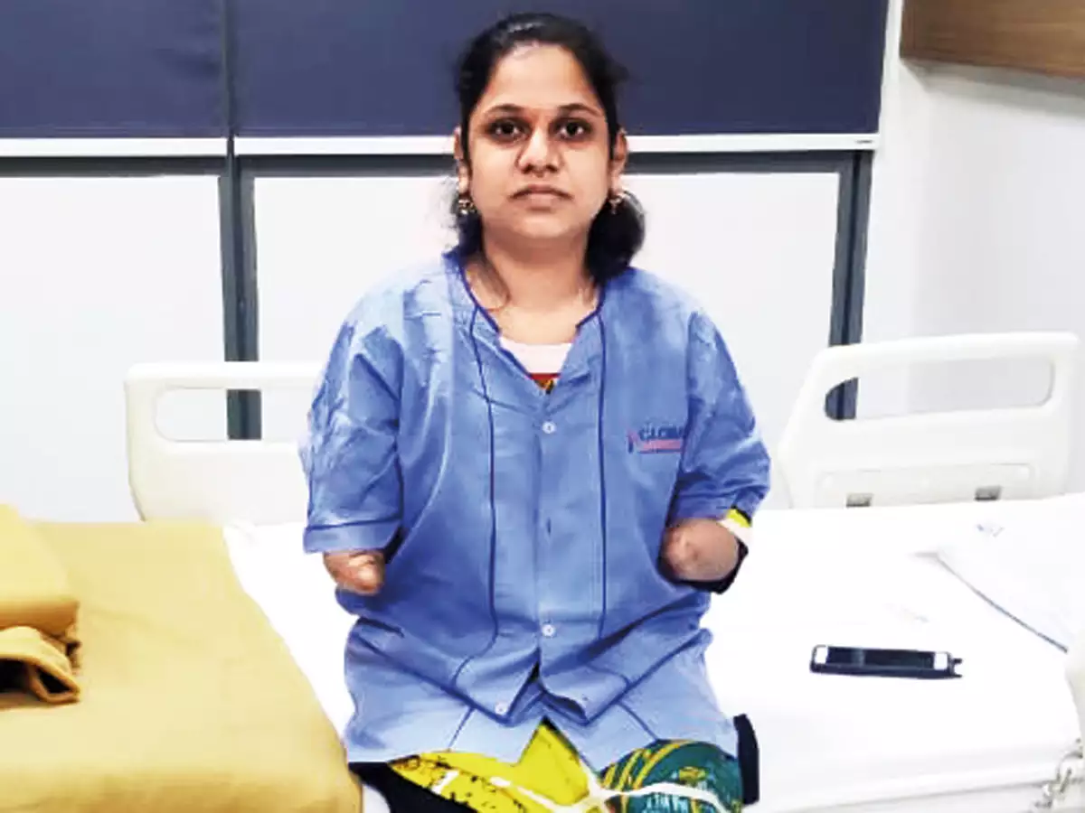 monica-more-who-had-lost-both-her-arms-in-accident-at-ghatkopar-station