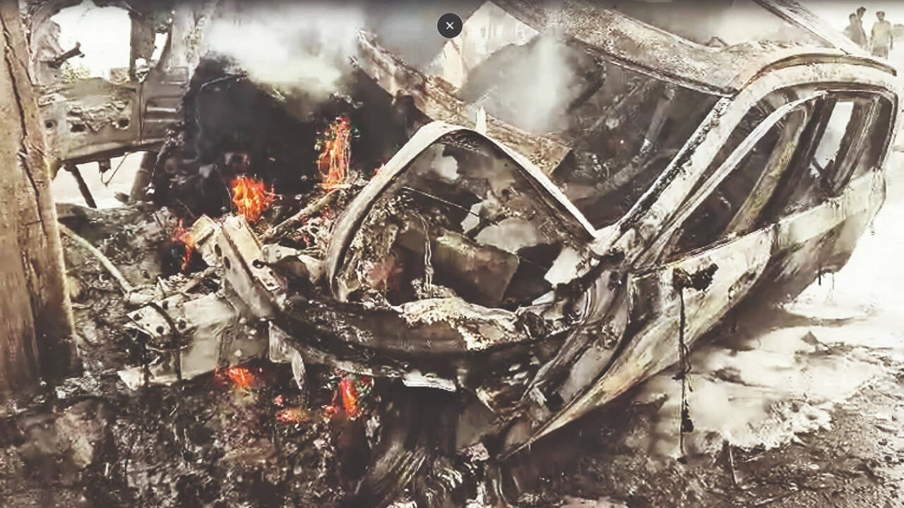 Neurosurgeon burned to death as his car hits divider in Telangana<br>