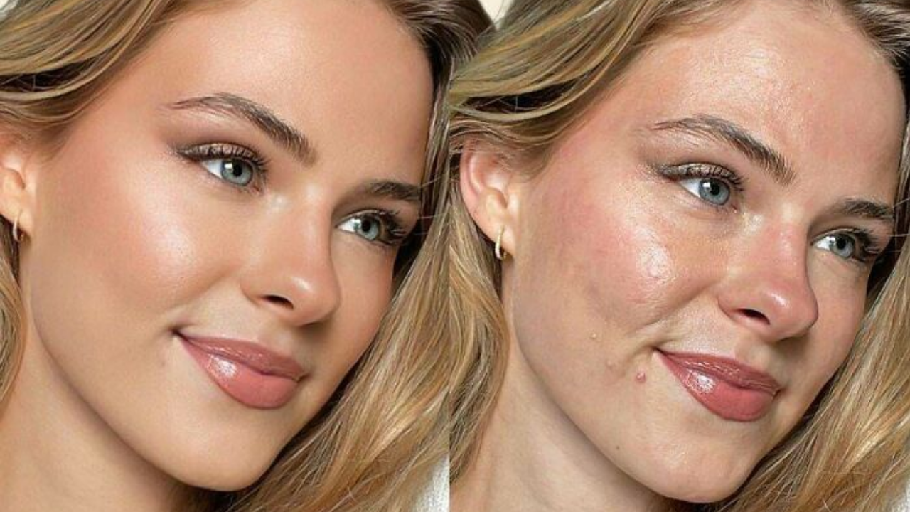 Beauty Filters And Cosmetic Procedures