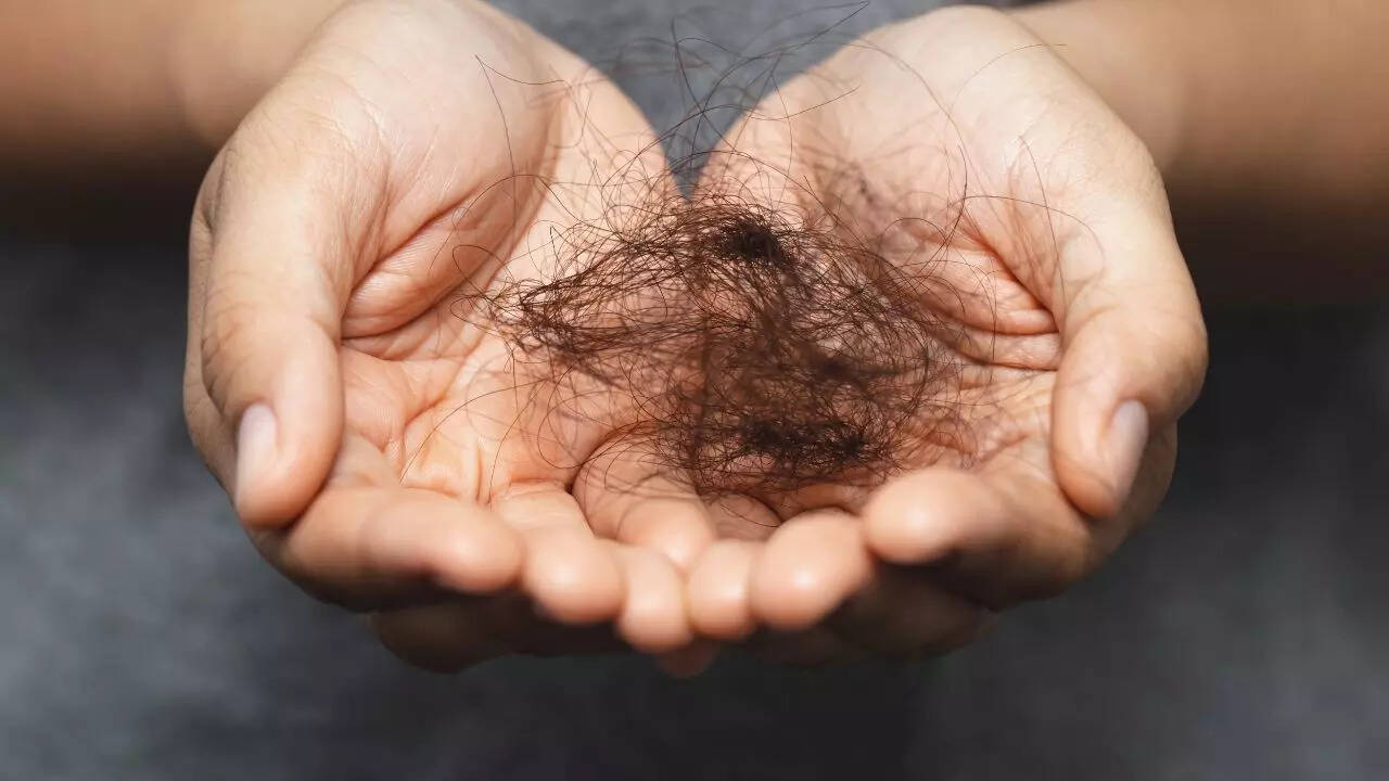 Normal Hairloss