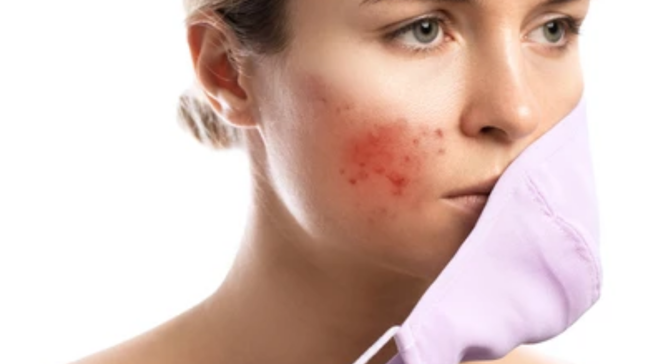 Red patches on skin