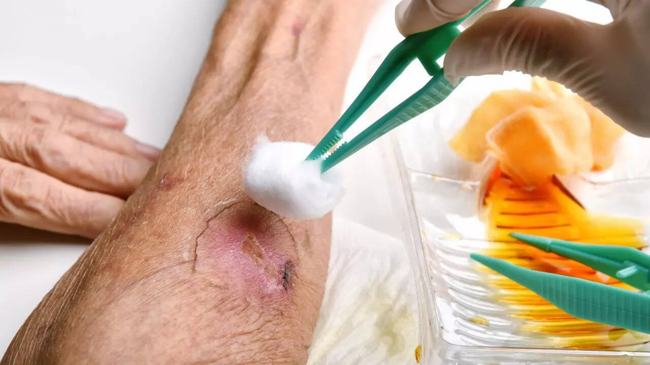 Wound healing and scar reduction