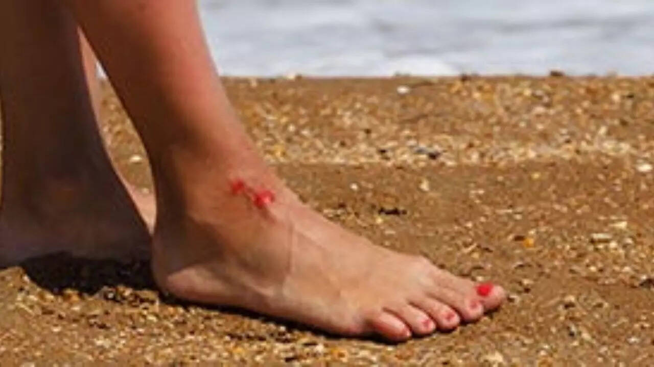 What are the symptoms of Vibrio Vulnificus infections?