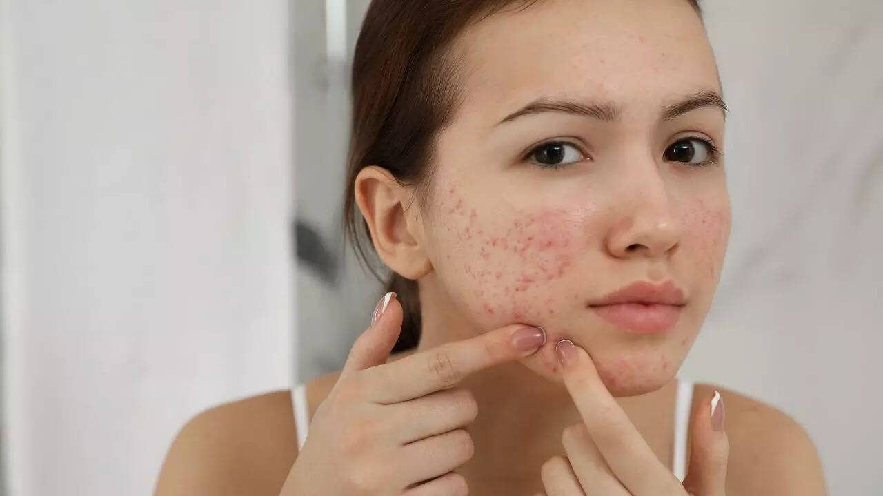 It’s gentle on sensitive or acne-prone skin