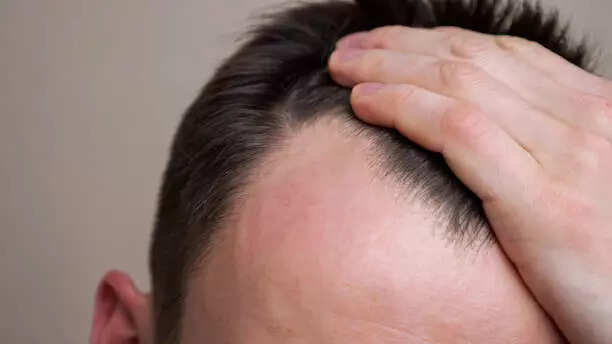istockphoto-1335343048-612x612