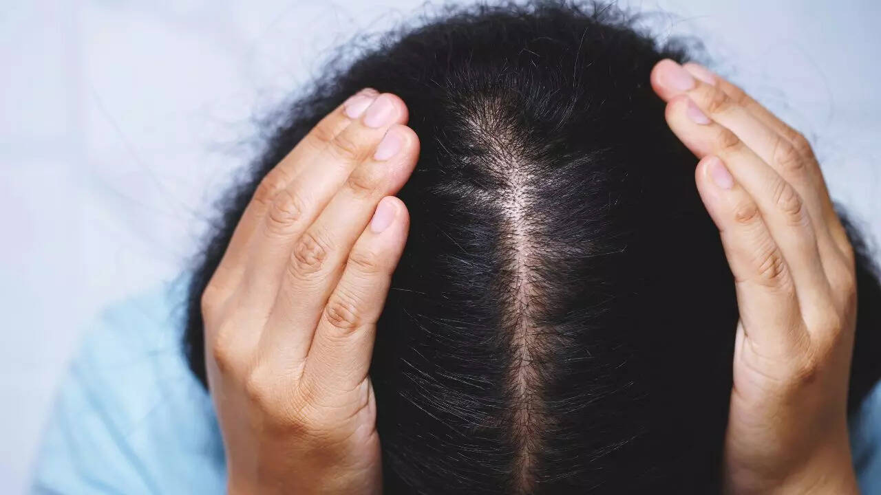 மீட்டெடுக்கப்பட்ட மூலக்கூறு சமிக்ஞைகள் மூலம் முடி உதிர்தல் மீளக்கூடியதாக இருக்கலாம்: புதிய ஆய்வு கண்டுபிடிக்கிறது