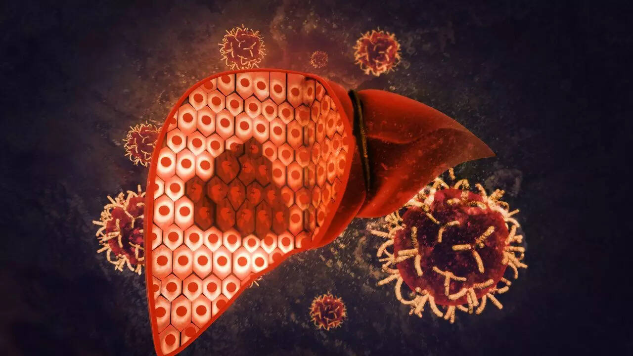 7 causes of fatty liver in women