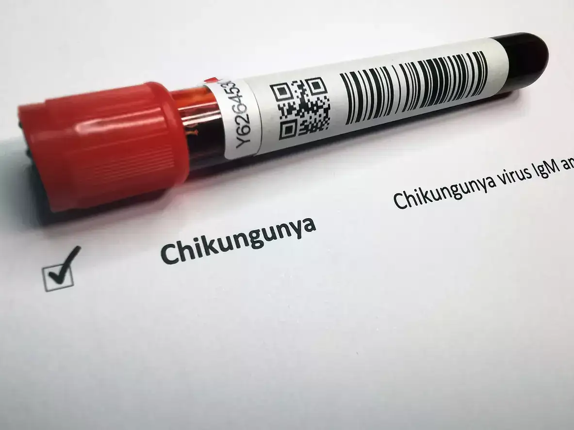 World Health Organization raises concern about spread of mosquito-borne Chikungunya virus