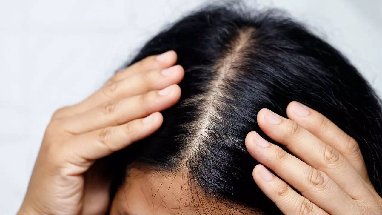 Hair loss and brittle nails