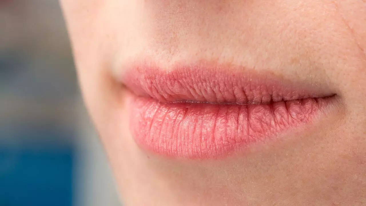 Cracked lips or mouth sores