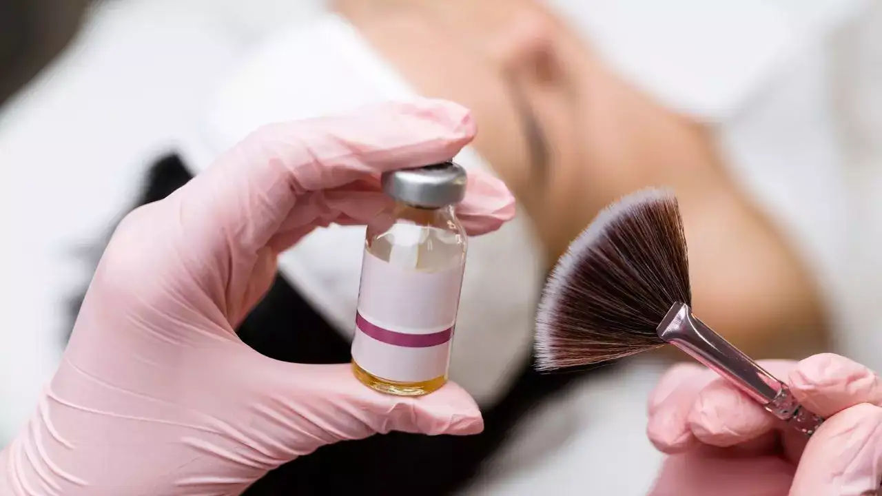 Try chemical peels