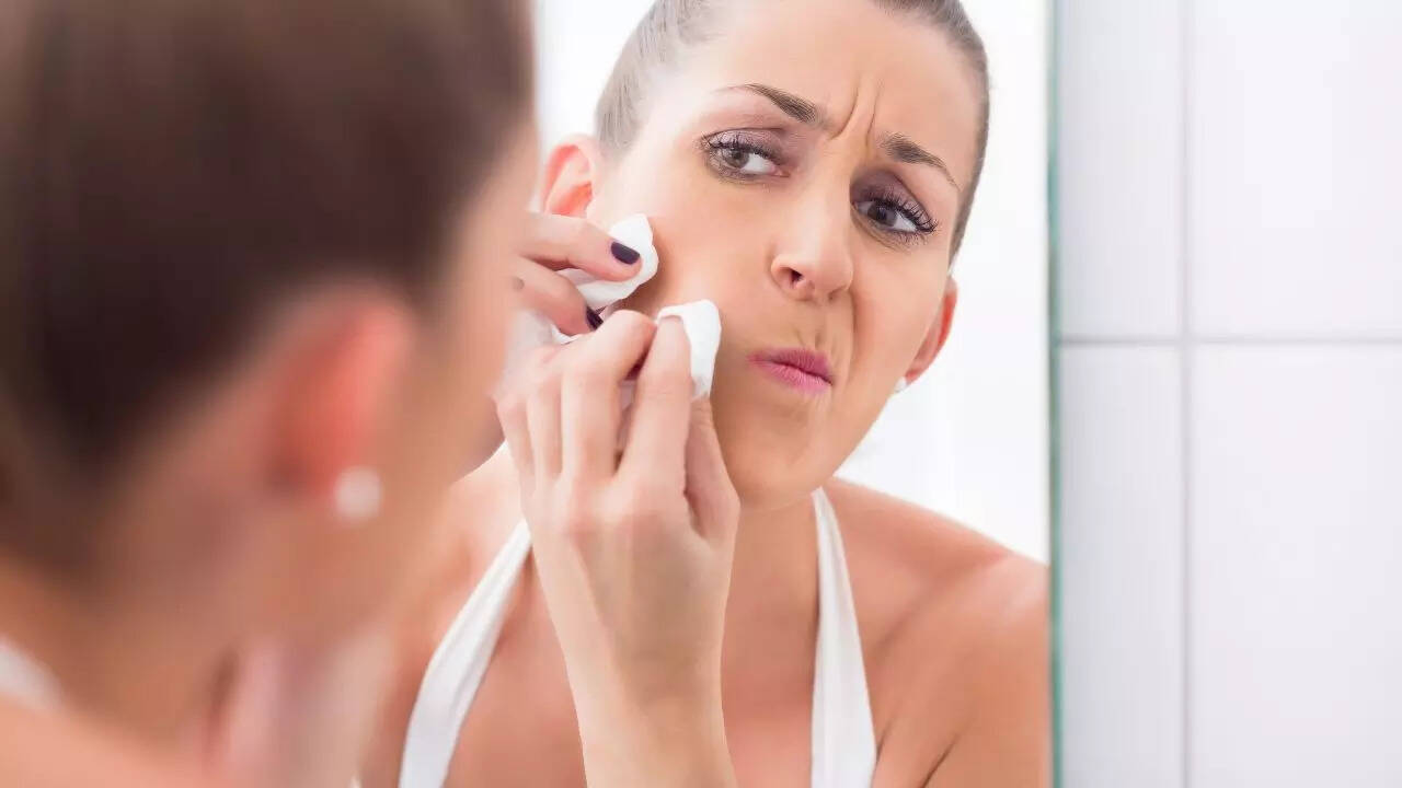 Avoid popping pimples