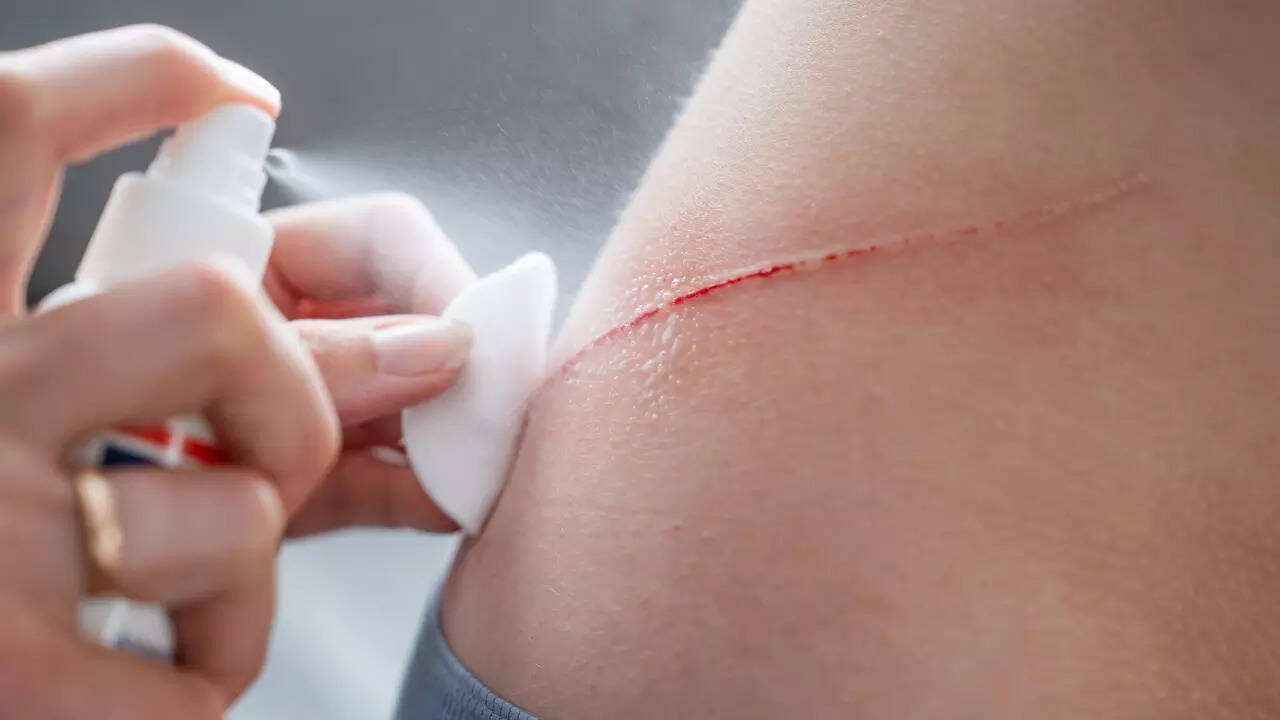 scratch