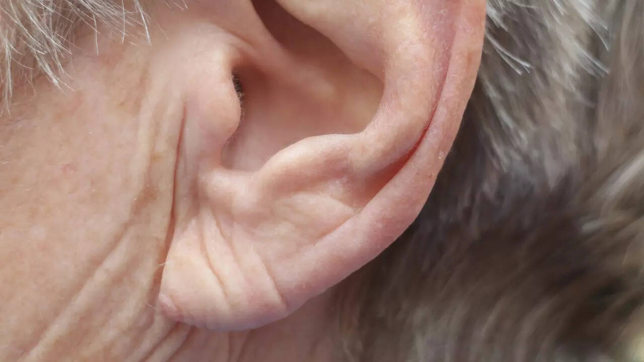 ear lobe