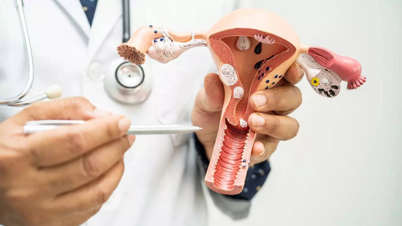 Uterus removal