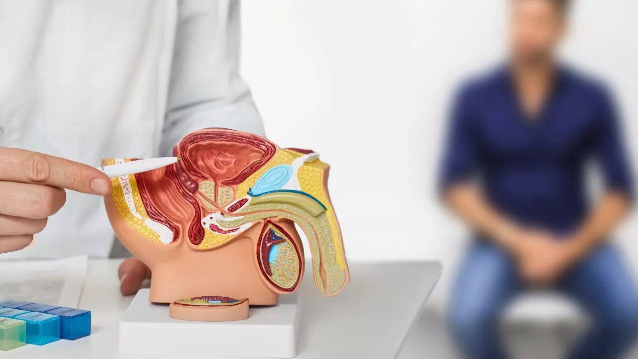 Prostate cancer