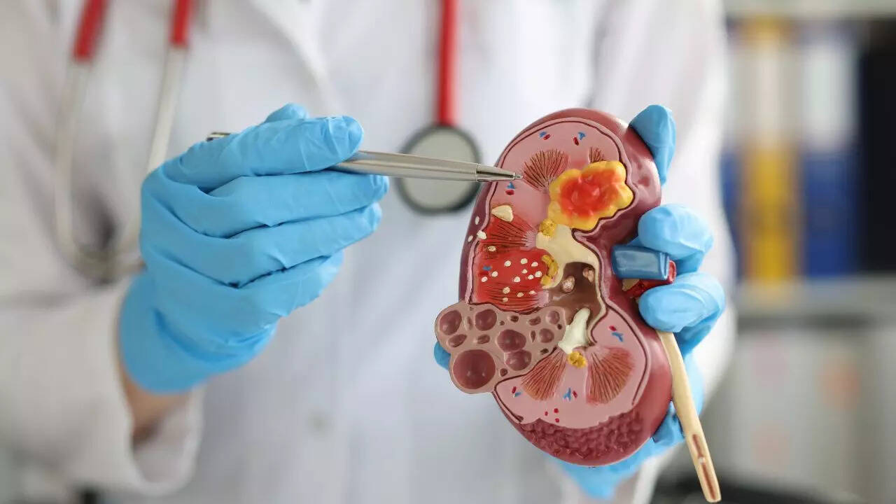 Kidney disease
