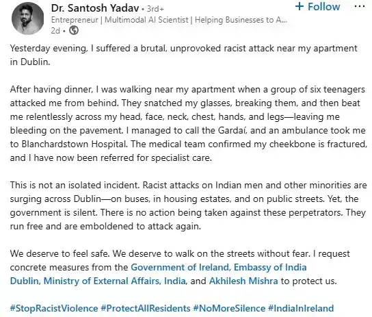 Dr Santosh Yadav posted on LinkedIn how he was attacked by a teenage group when he was on his post-dinner walk near his apartment in Dublin. Dr Santosh Yadav posted on LinkedIn how he was attacked by a teenage group when he was on his post-dinner walk near his apartment in Dublin.