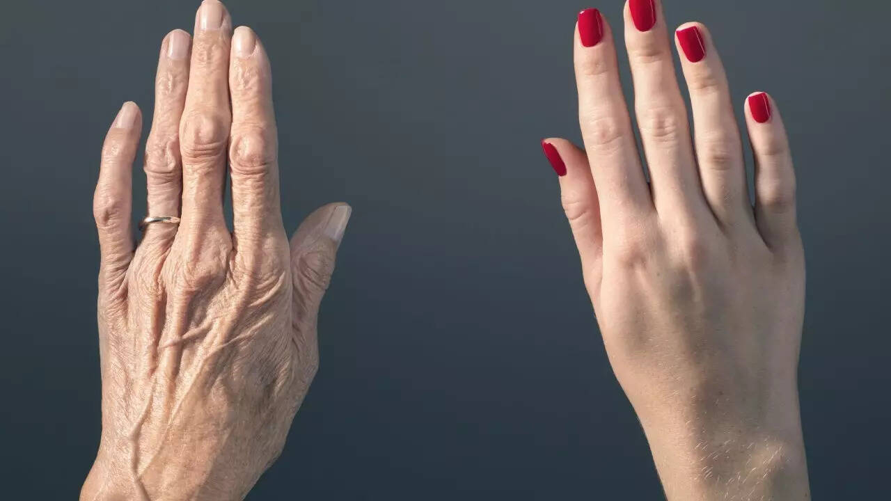 Aging (1)