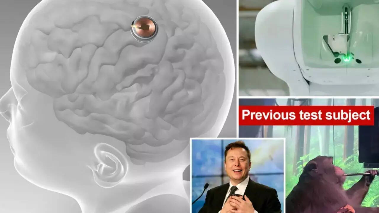 Source: New York Post Neuralink human trials reveal stunning breakthroughs for paralysed patients
