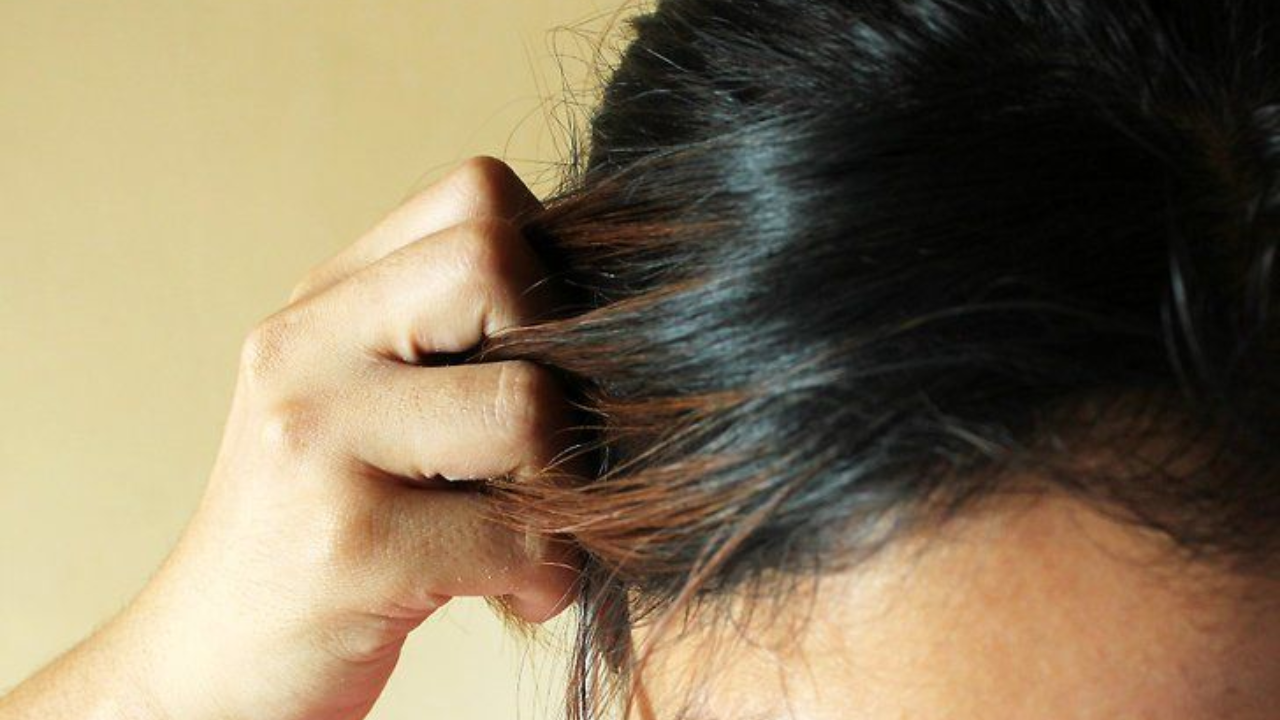 Hair loss because of dehydration!