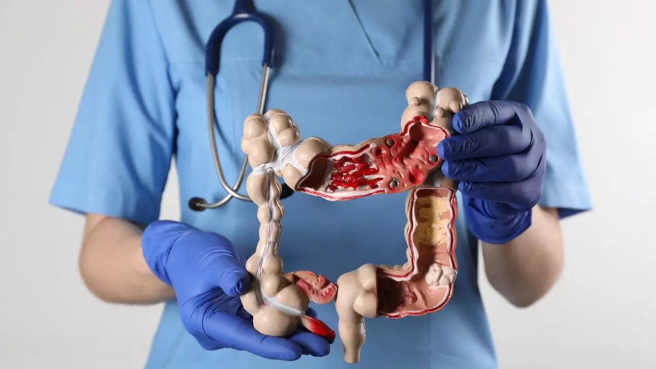Colon health and cancer prevention